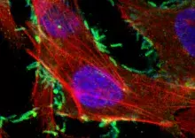 Linia AGS z H. pylori