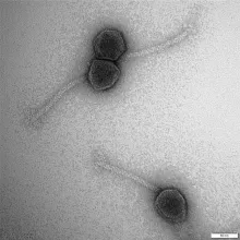 Bakteriofagi  (fot. dr hab. Magdalena Narajczyk z Laboratorium Bioobrazowania WB UG)